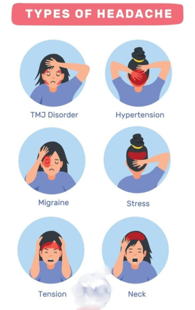 TYPES OF HEADACHE