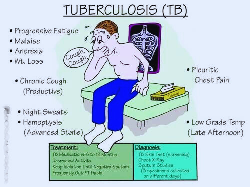 Tuberculosis (TB): Complete information on symptoms, causes, prevention and treatment